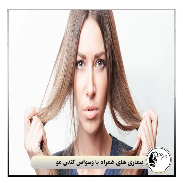 بیماری‌های همراه با وسواس کندن مو